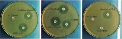 Molecular Epidemiology and Risk Factors of Ventilator-Associated Pneumonia Infection Caused by Carbapenem-Resistant Enterobacteriaceae